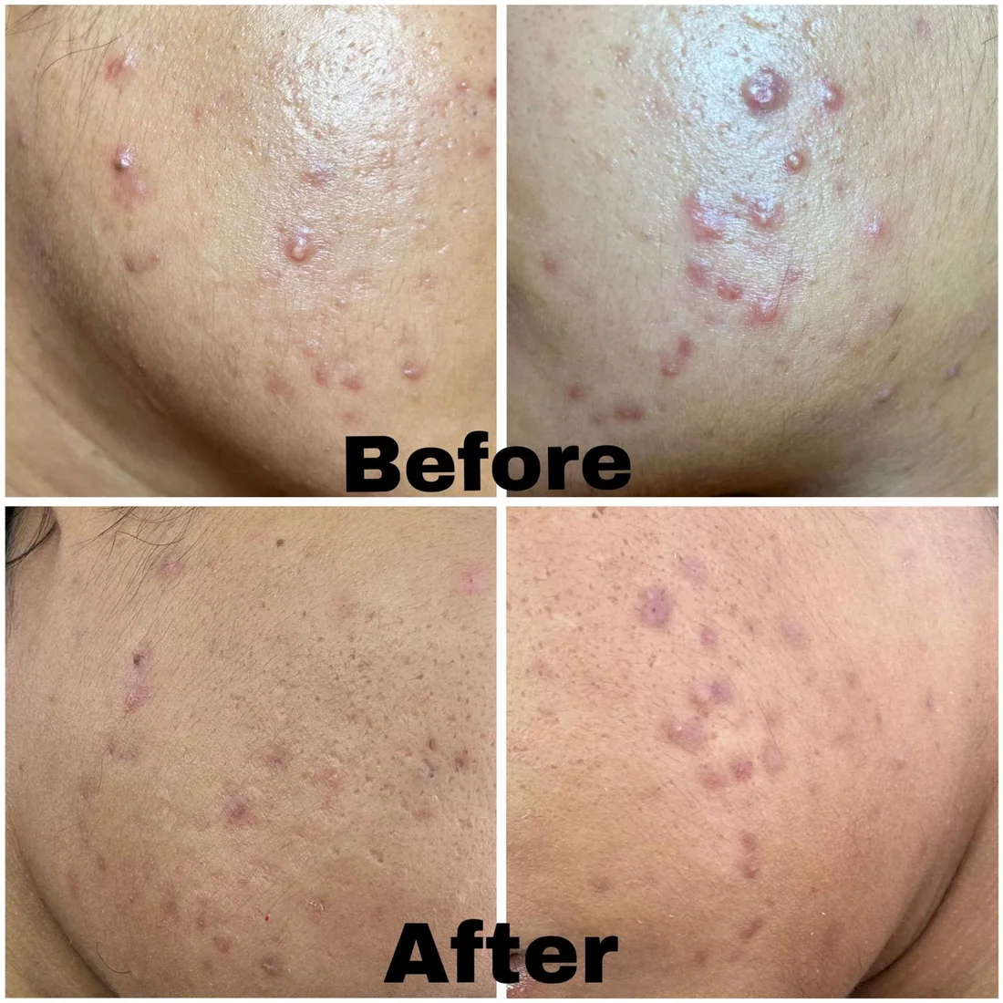 Facial client result 2