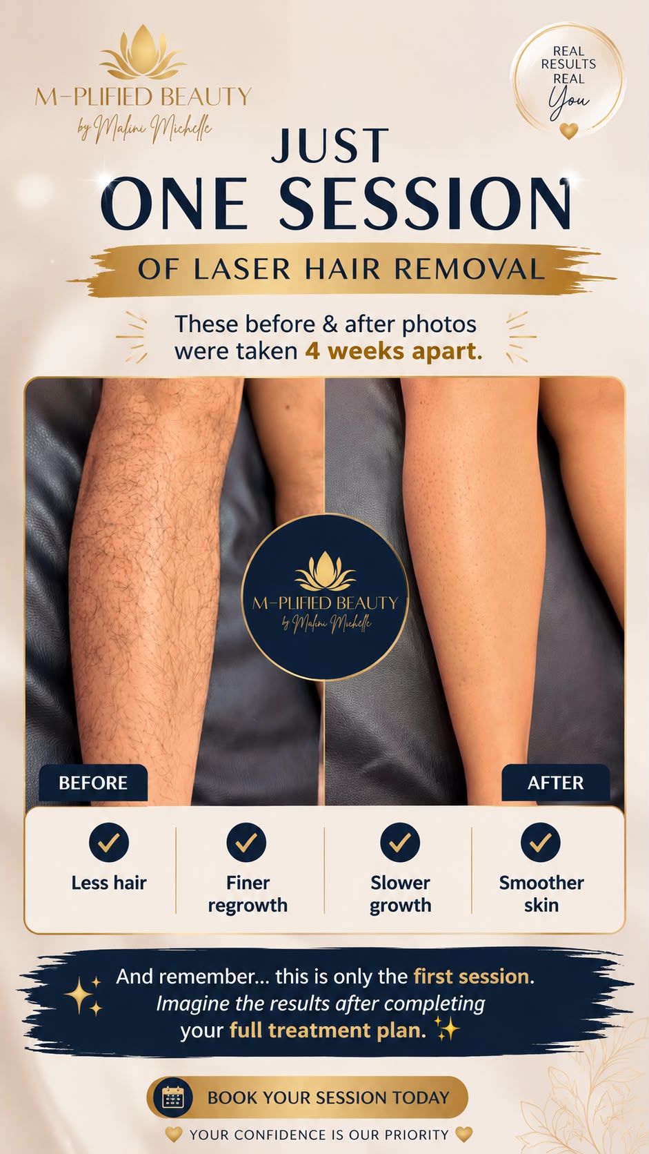 Laser Hair Removal client result 2