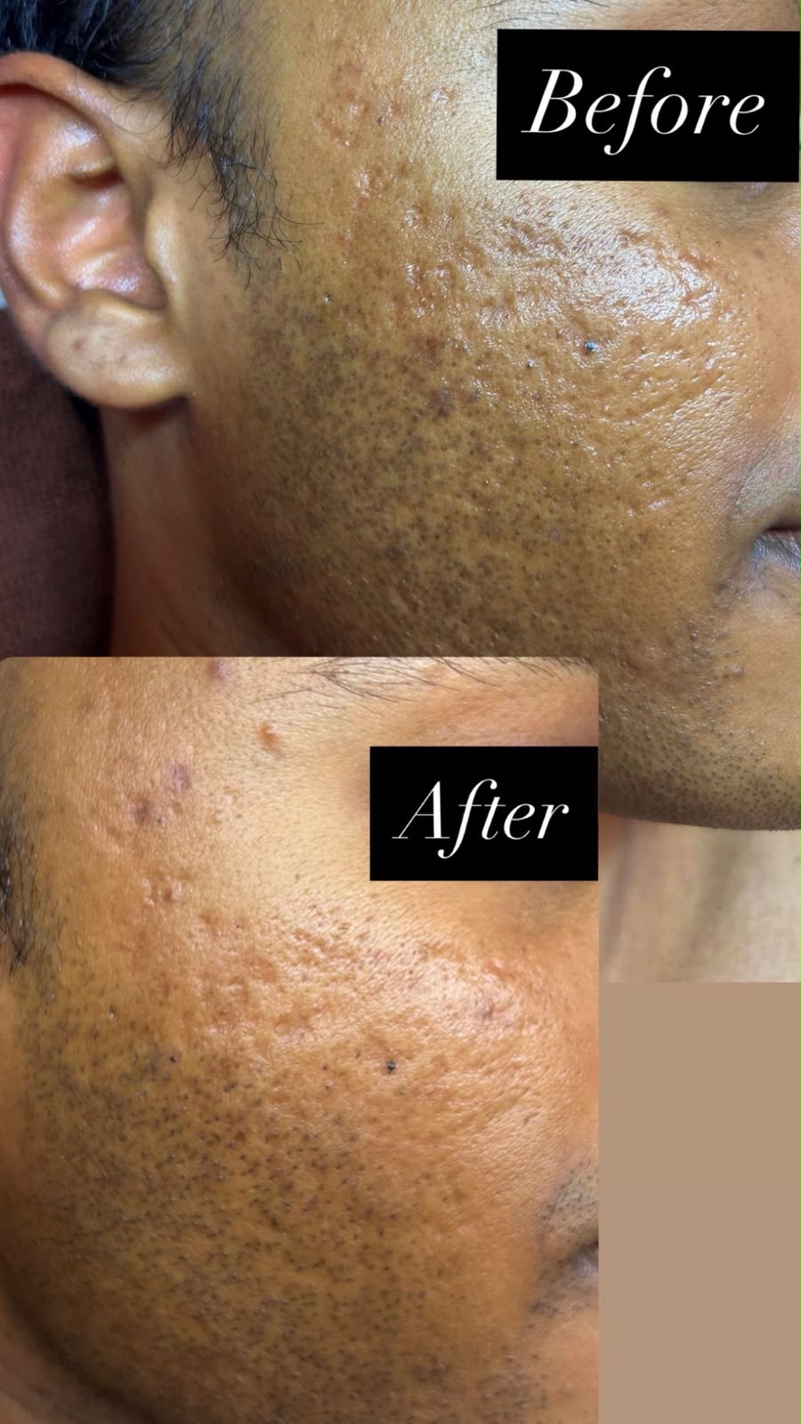 Facial client result 1
