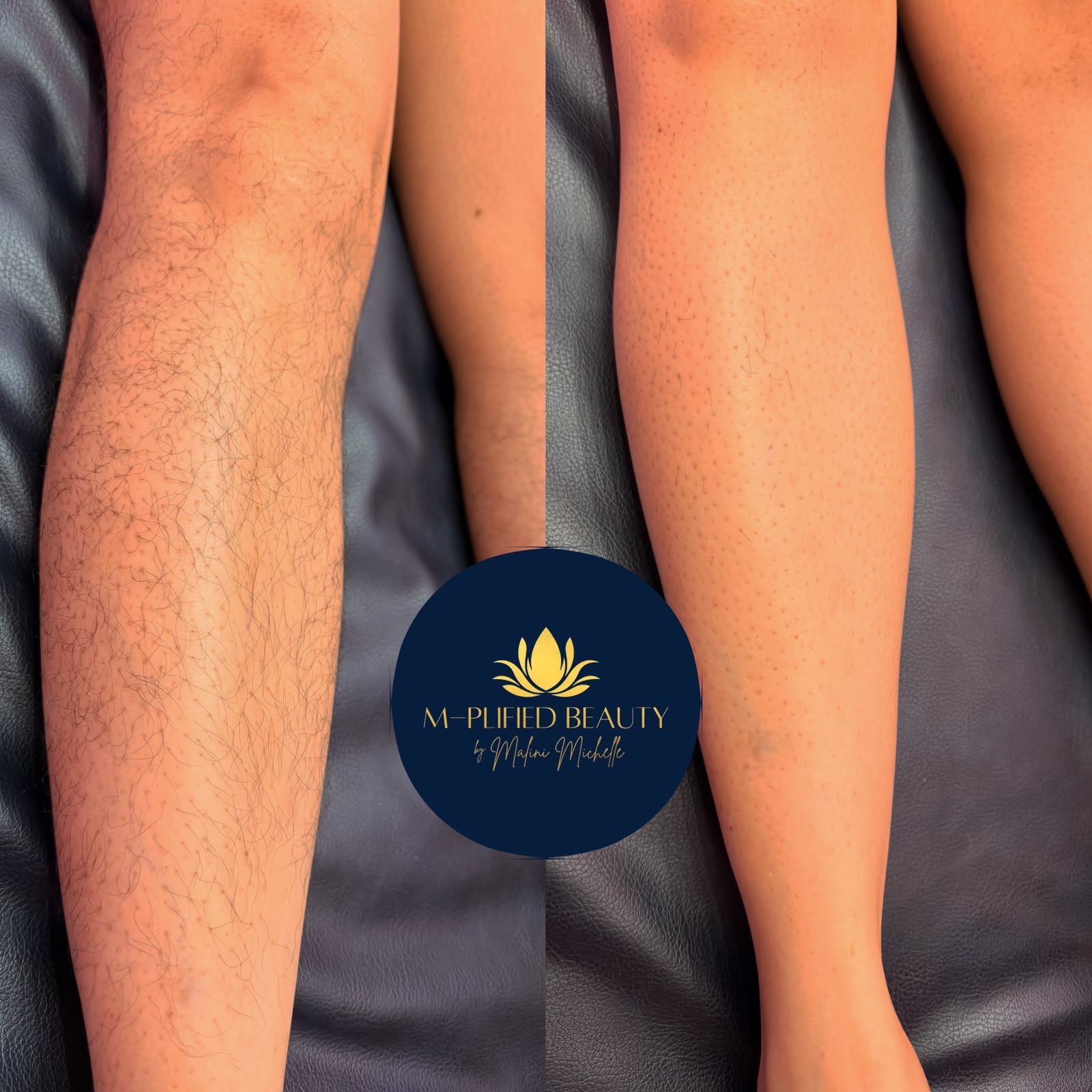 Waxing client result 1